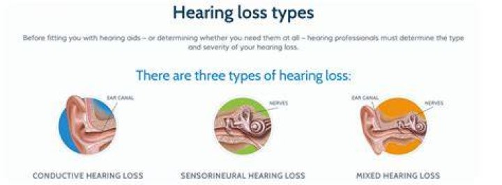 What are 3 types of hearing loss?